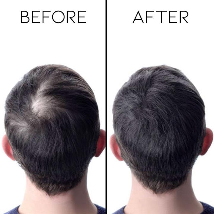 Ginger Extract Hair Growth Essential Oil Hair Care Every Day And Night 