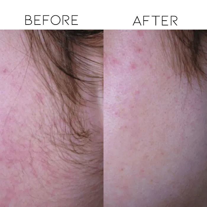 Painless Hair Removal Sponge Personal Care Every Day And Night 