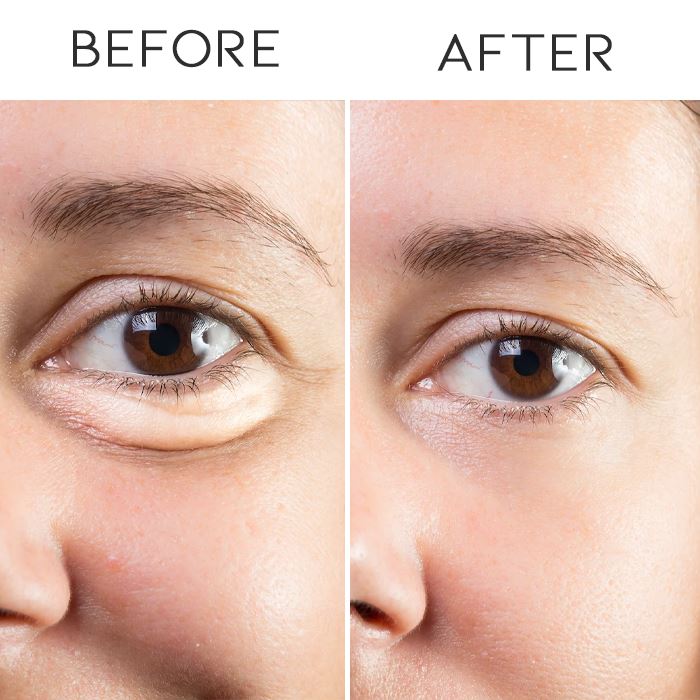 Anti-Wrinkle Eye Cream With Electric Massager Personal Care Every Day And Night 
