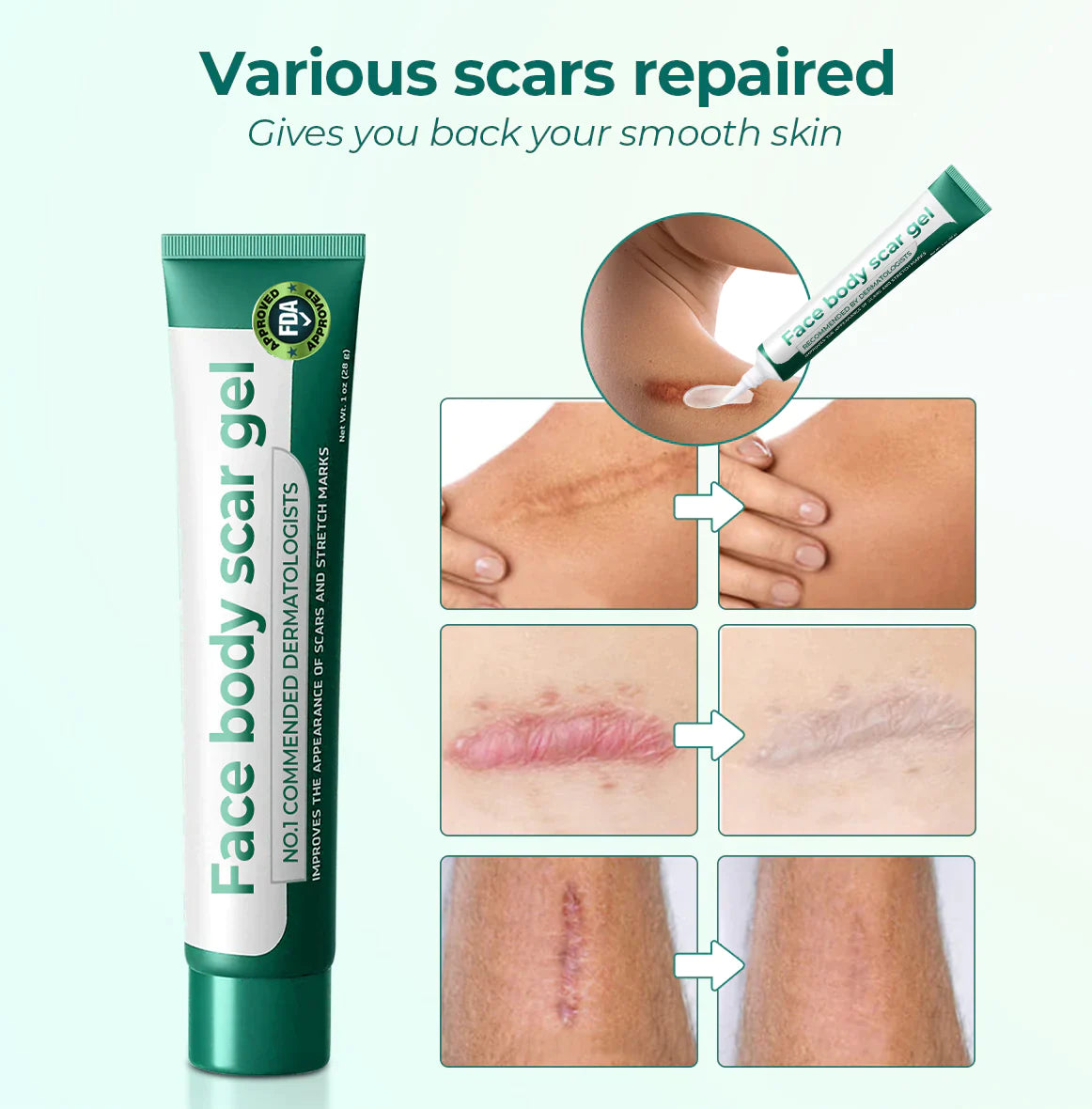 Fivfivgo™ Gel cicatriciel à base de cellules souches Advanced Medical