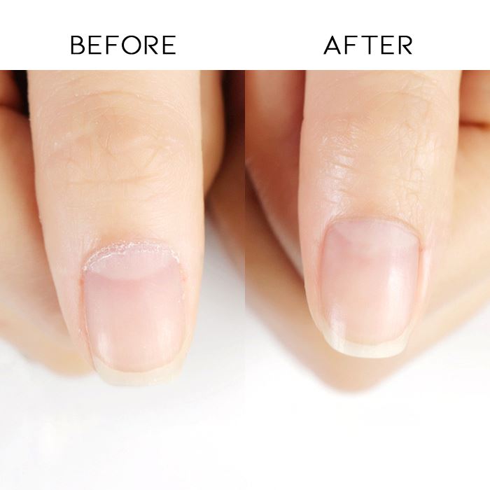 Vitamin E Deep Nourishing Cuticle Oil Nail Every Day And Night 