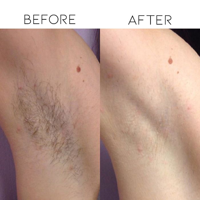 Painless Hair Removal Sponge Personal Care Every Day And Night 