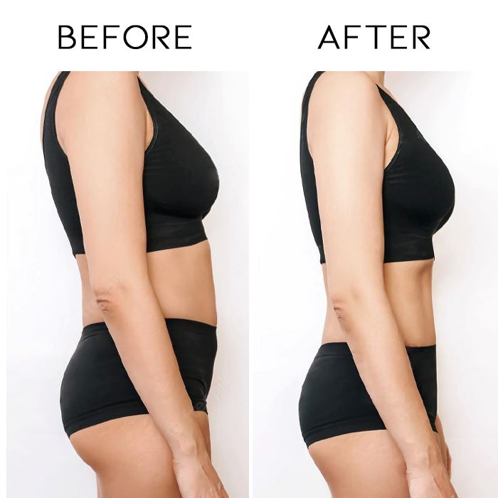 Burn+ Belly Shaping Patch Personal Care Every Day And Night 