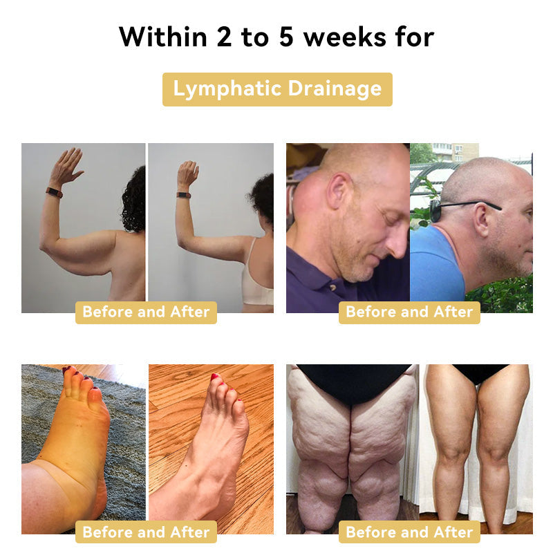 Fivfivgo™ Bee Venom Slimming Cream