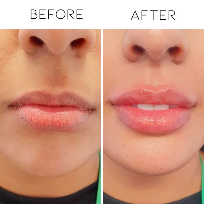 Like-A-Filler Lip Plumper Make-up Every Day And Night 