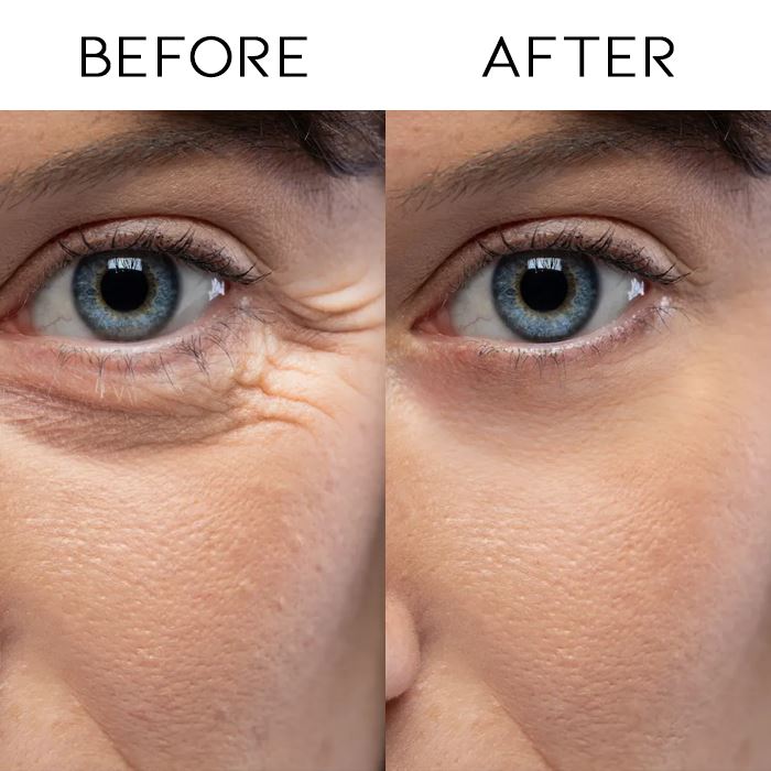 Oligopeptide Moisturizing Anti-Wrinkle Eye Mask Personal Care Every Day And Night 