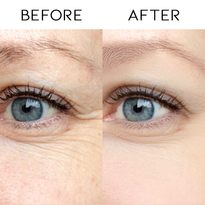 Oligopeptide Moisturizing Anti-Wrinkle Eye Mask Personal Care Every Day And Night 