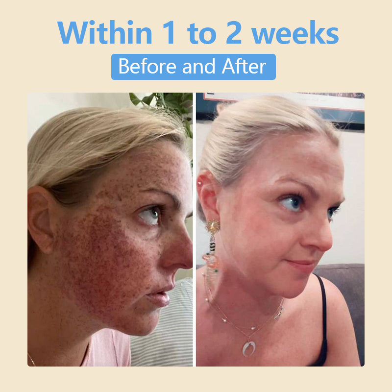 Fivfivgo® Bean Essence Serum – Gently Exfoliates, Hydrates & Helps Fade Dark Spots