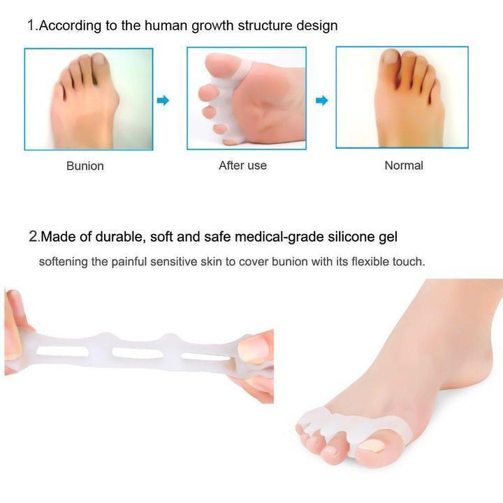 Toe Separators