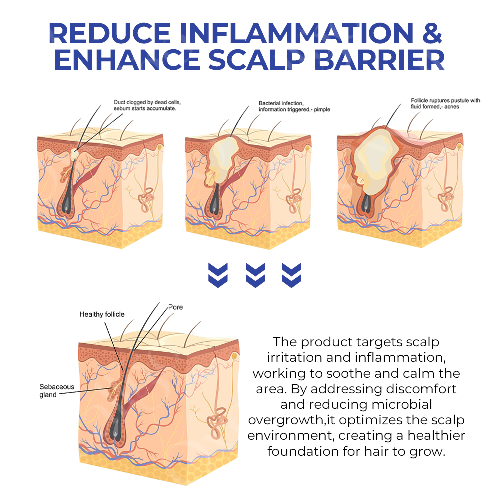 ✅Offizieller Shop: Fivfivgo™ BeeGrow Follicle Reviving Hair Essence 🌿 Anerkannt von AHLA & USP (klinisch erwiesen, um Haarfollikel zu aktivieren, die Gesundheit der Kopfhaut zu verbessern, Entzündungen zu reduzieren und Haarausfall zu verhindern)