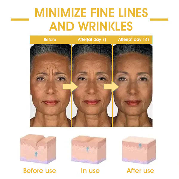 Fivfivgo™ Skin-Firming Tightening Body Serum