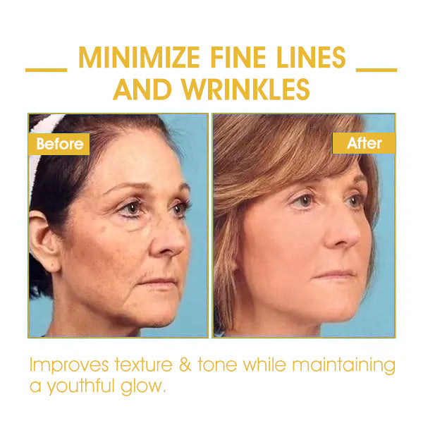 Fivfivgo™ Skin-Firming Tightening Body Serum