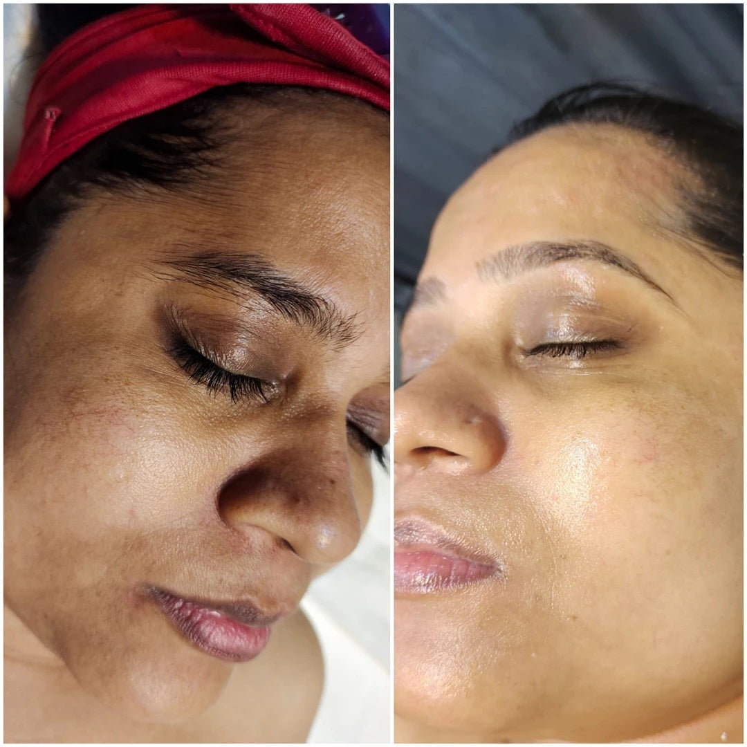 Fivfivgo™ Revita Glow Spot Whitening Serum