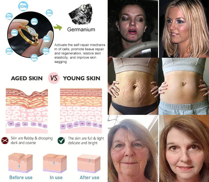 Fivfivgo™ Mikro-Nano-Fusion Diamant-Entgiftungsring - Verbessern Sie Ihre Gesundheit ✨💎