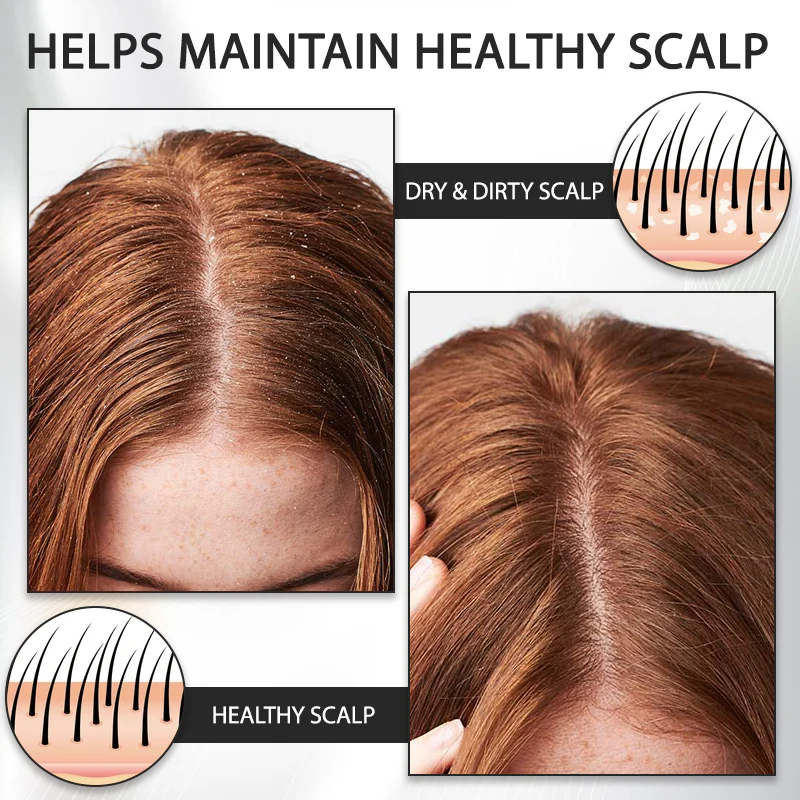 Fivfivgo™ Alopecia Recovery Hair Booster Roll-On