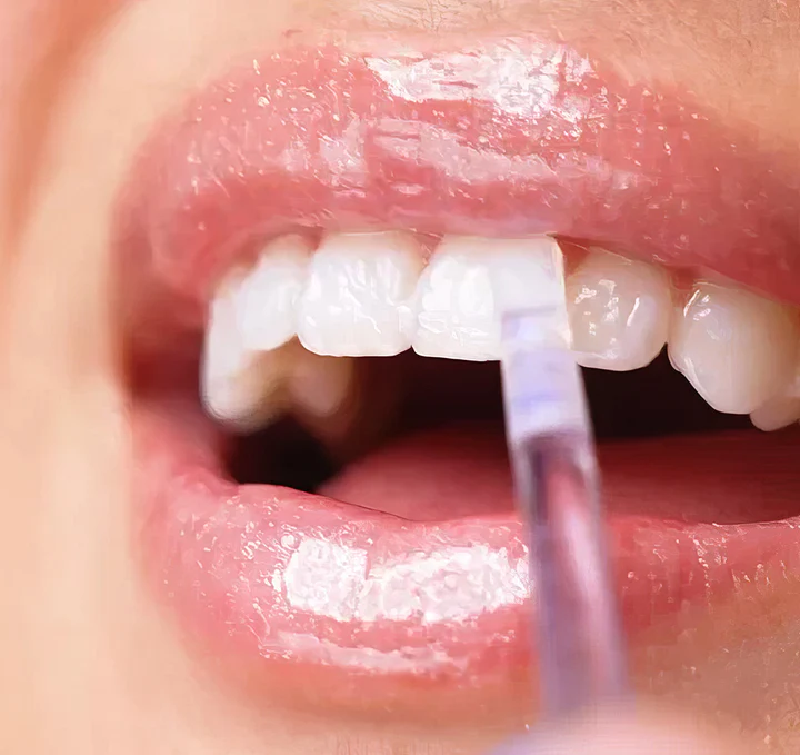Fivfivgo™ NiceSmile Teeth Whitening Essence