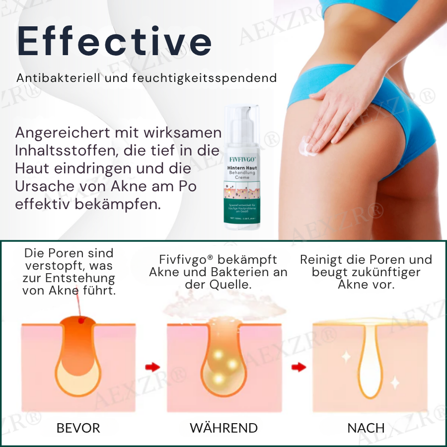 Fivfivgo® Hintern Haut Behandlung Creme