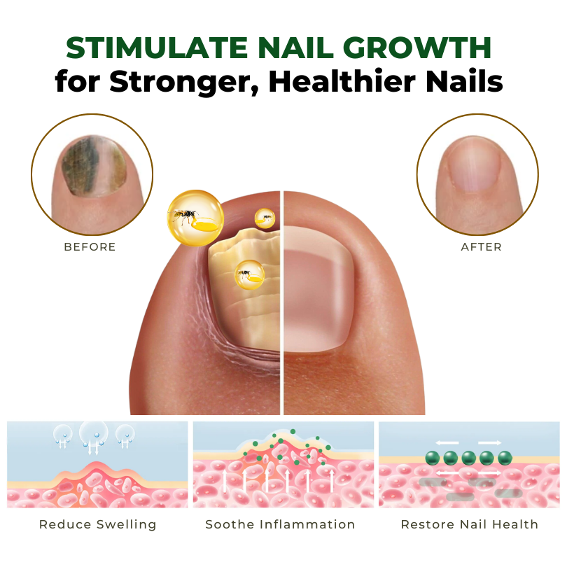 Fivfivgo™ NailNurture Bienengift Fungus Behandlungsöl