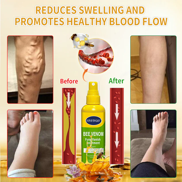 Fivfivgo™ BeeVenom FungiVanish-Behandlungsspray👨‍⚕️ (Fördert die Nagelregeneration, beseitigt wirksam Nagelpilz, Fußpilz und Fußgeschwüre)