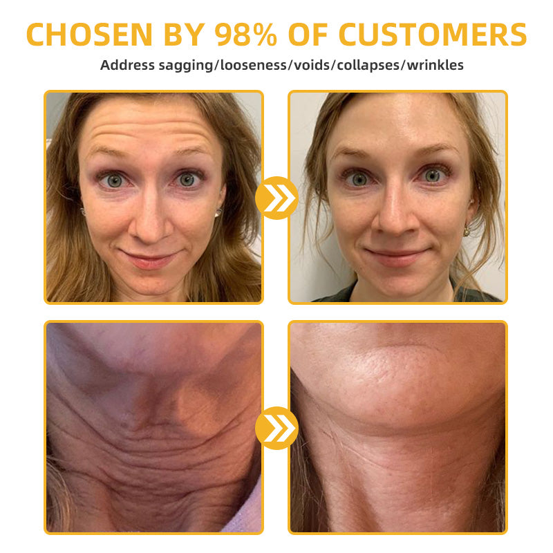 Fivfivgo™ BeeLift Anti-Aging Firming Cream (Address Crepe & Sagging) 🔥 LAST DAY SALE 70% OFF