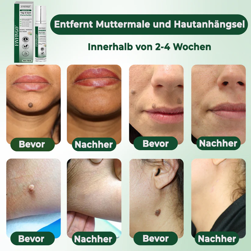 Fivfivgo® Reedle Shot 100 Tag & Spot Zielscheibe Fortgeschrittenes Serum