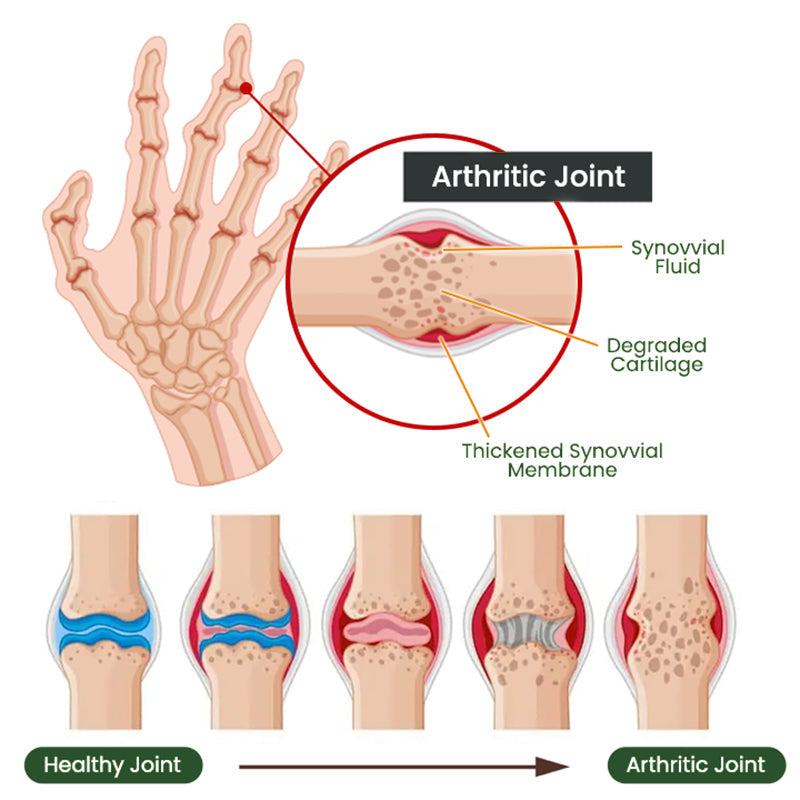 NovaRX® Bee Venom Bone & Joint Revive Spray