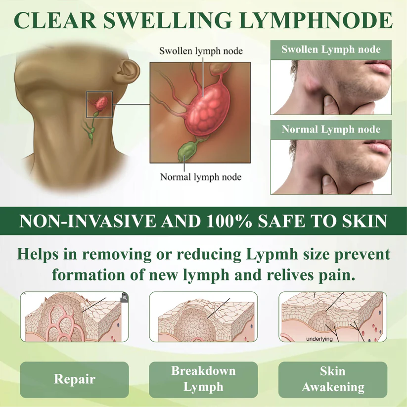 Fivfivgo™ SwellSoothe Lymphatische Creme