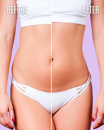 Fivfivgo™ Hautstraffende Creme