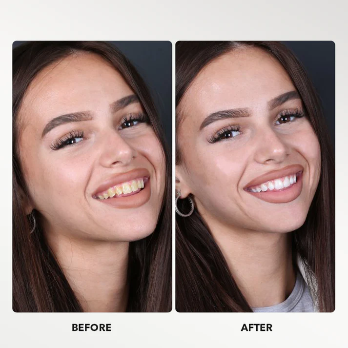Fivfivgo™ Teeth Whitening Powder