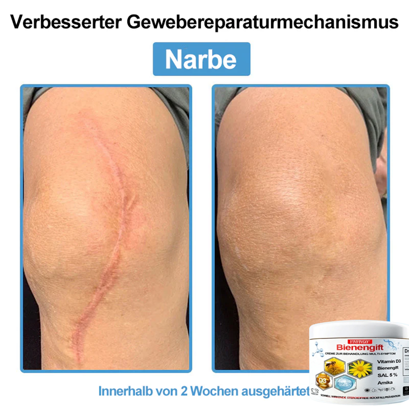 Fivfivgo™ Bienengift Creme Zur Behandlung Multi-symptom