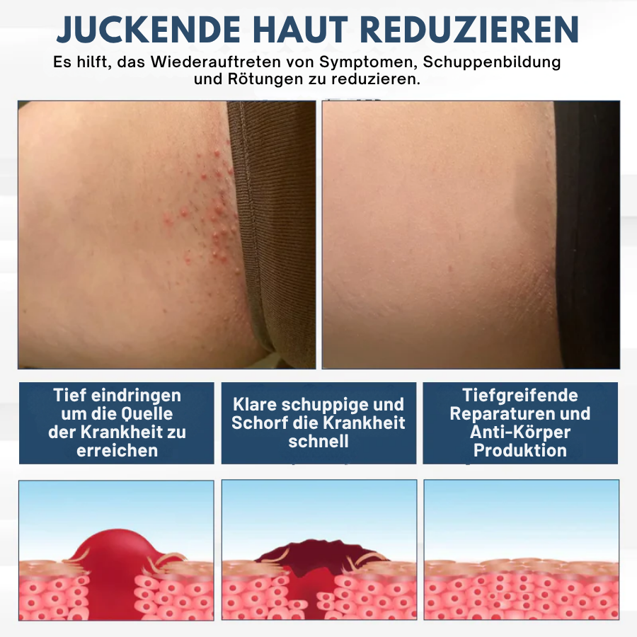 Fivfivgo® LicorRelief Mann Genital Antimykotisch Creme