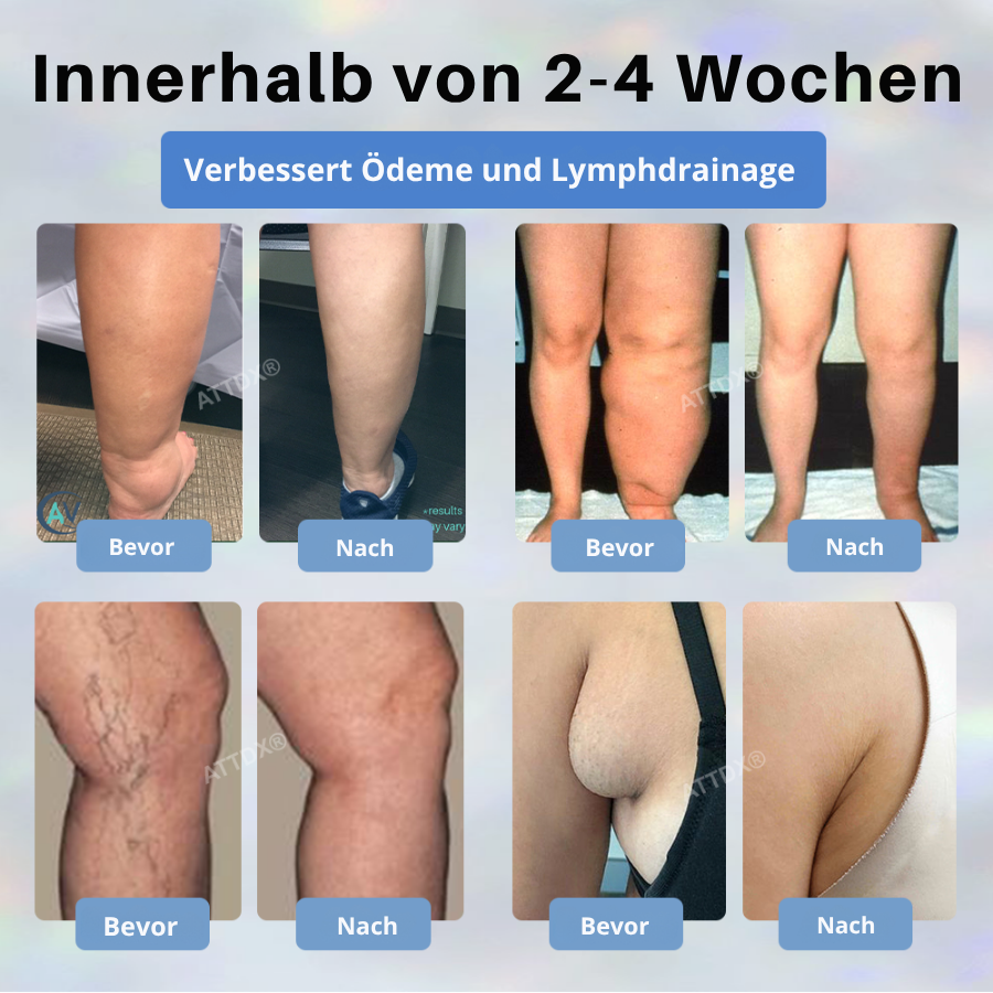 Fivfivgo® Schwarzkümmel Ödeme lindernde Kräutercreme