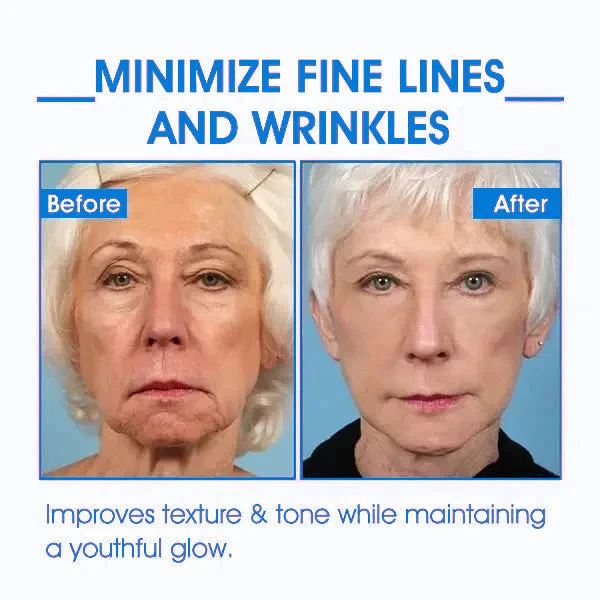Fivfivgo™ Advanced SkinTightening Rejuvenating Cream: Restore Skin Elasticity