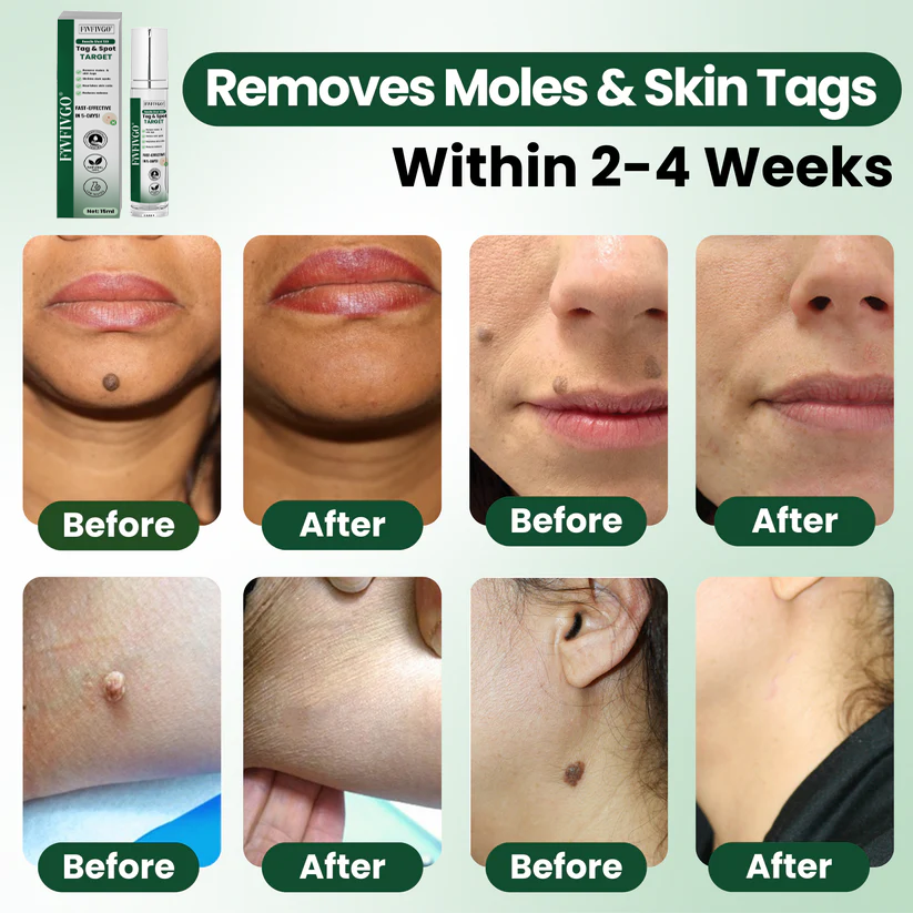 Fivfivgo® Reedle Shot 100 Tag & Spot Target Advanced Serum