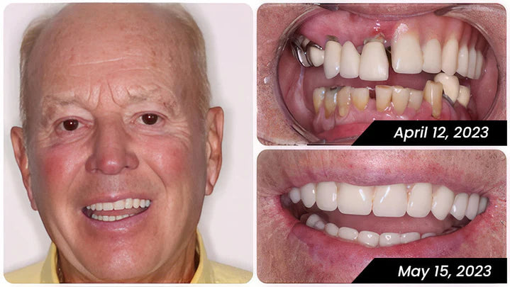 Fivfivgo™ Bamboo Charcoal Whitening Toothpaste