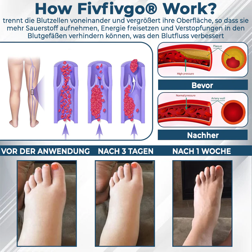 Fivfivgo® VenoHerb Schwarzkümmel-Ödemlöser-Balsam