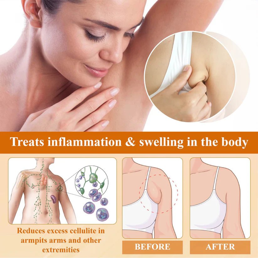 Fivfivgo™ EdemaSlim Care Detox Body Cream