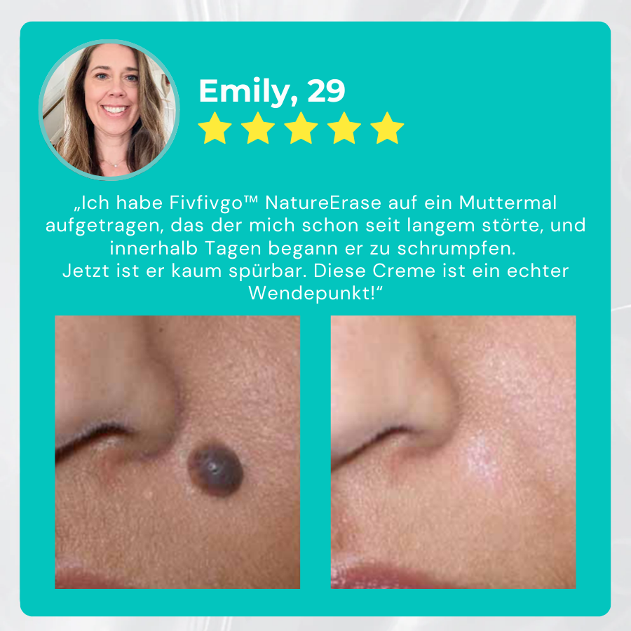 ✅ Offizieller Laden: Fivfivgo™ NatureErase Sofortige Maulwurf- und Fleckencreme