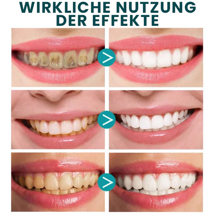 Fivfivgo® Sofortige Zahnaufhellungsfarbe