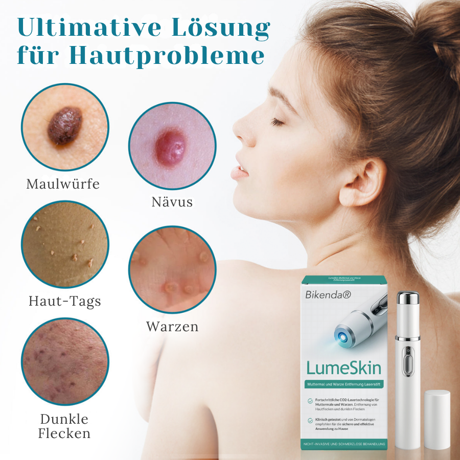 Bikenda® LumeSkin Muttermal und Warze Entfernung Laserstif