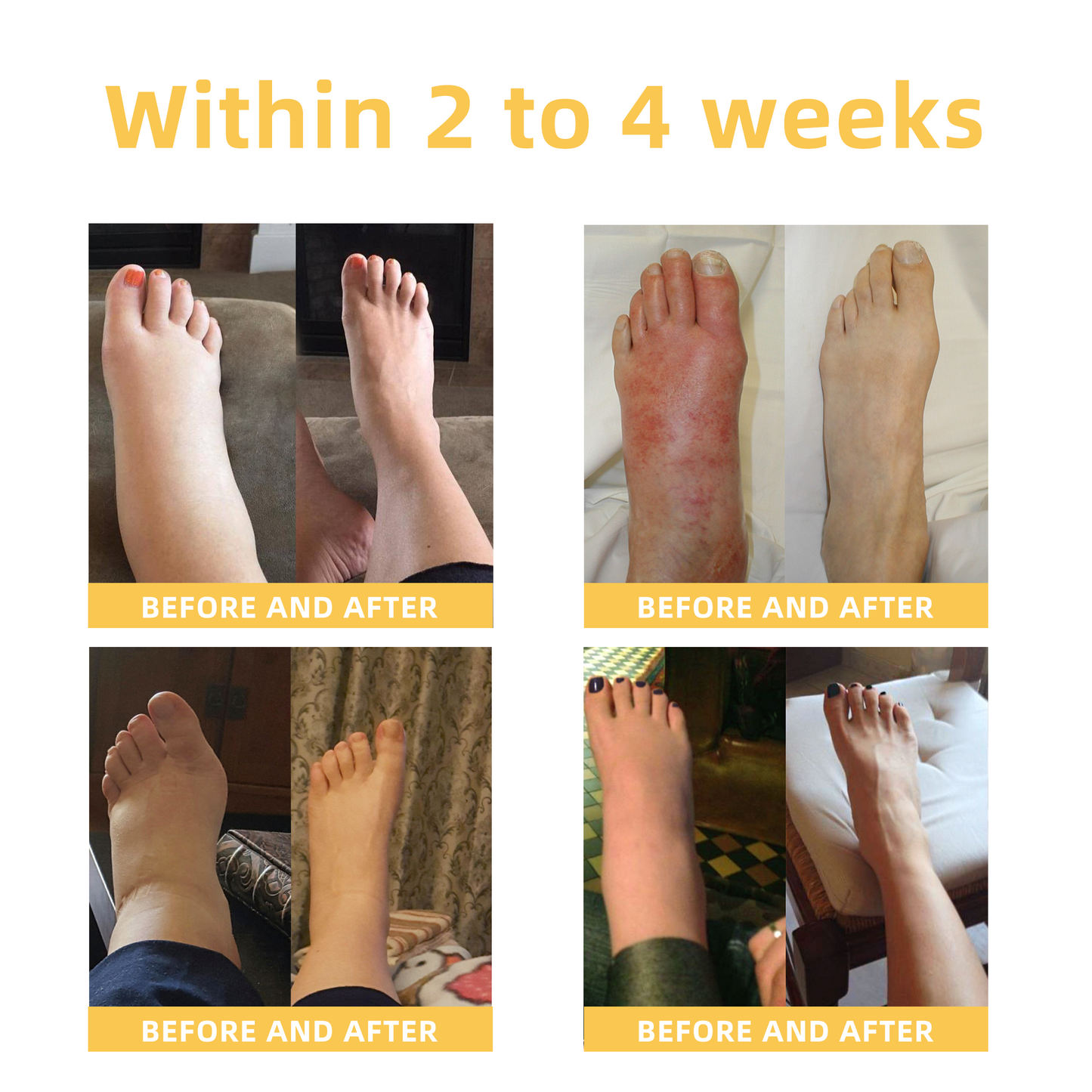 Fivfivgo™ Arthritis und Varikose Behandlung Creme