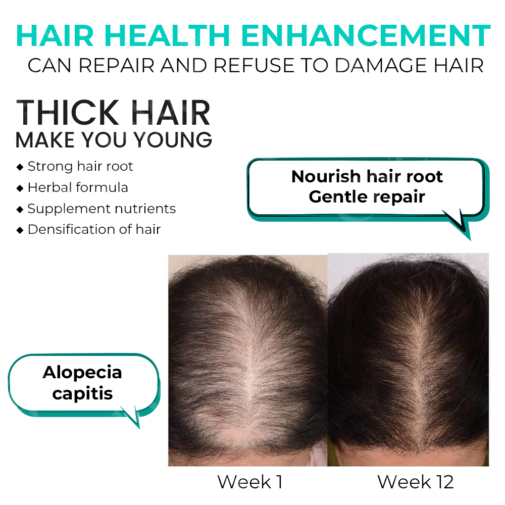 Fivfivgo™ ScalpReboost NMN Haarwuchs Roller