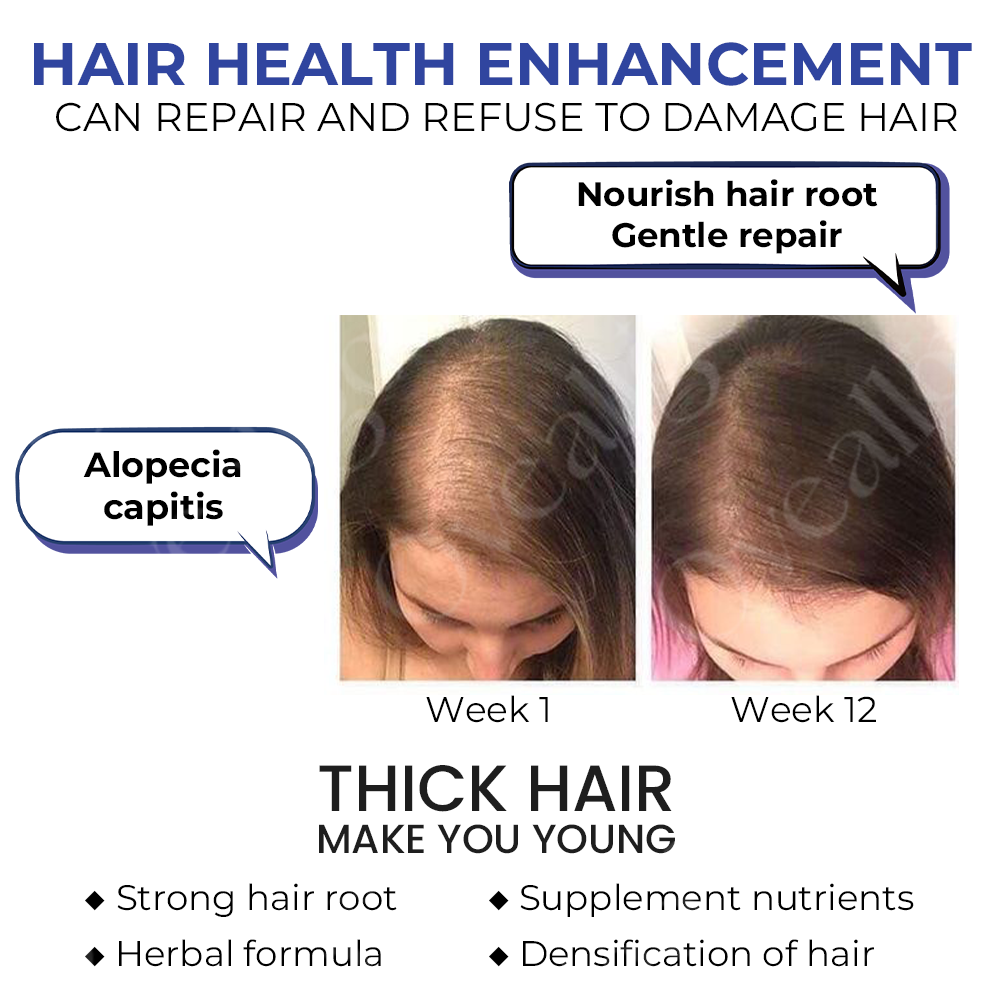 Fivfivgo™ ReVita Haarwachstumsserum - Minoxidil Topische Lösung USP, 5% mit Biotin