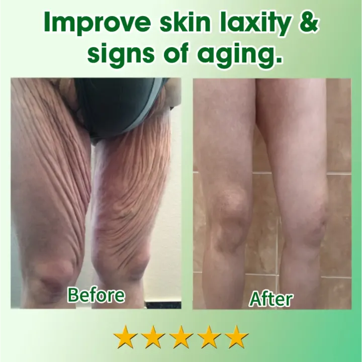 Fivfivgo™ 30 Herbal Firming Slimming & Detox Foot Bath Beads (Effective Treatment for High Blood Sugar and Arthritis)