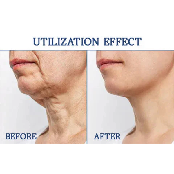 Fivfivgo™ Advanced SkinTightening Rejuvenating Cream: Restore Skin Elasticity