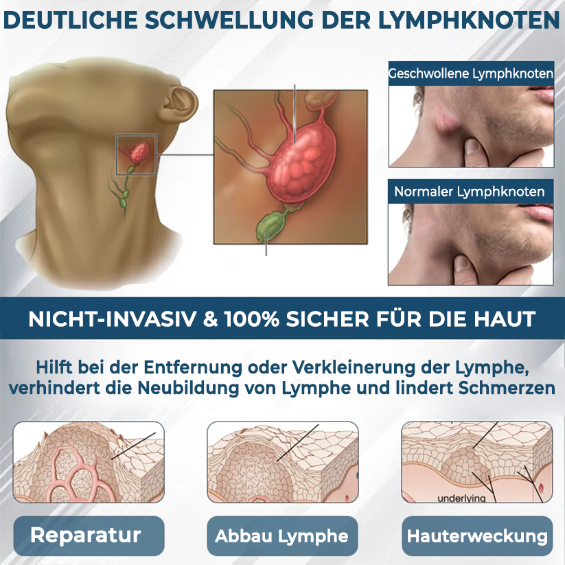 Fivfivgo® VenoHerb Schwarzkümmel-Ödemlöser-Balsam