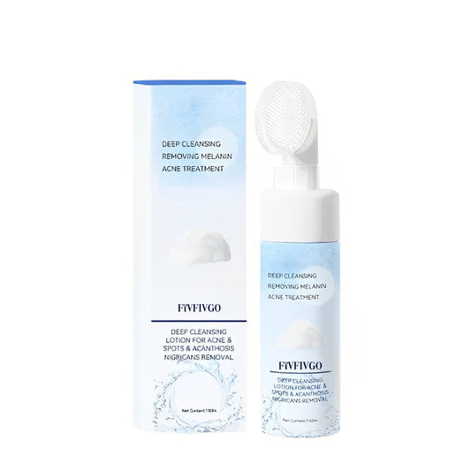 Fivfivgo™ Syväpuhdistava voide akneen & finneihin & Acanthosis Nigricansin poistoon