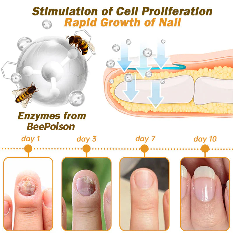 Fivfivgo™ Nagelpilz Bienengift Behandlung Serum