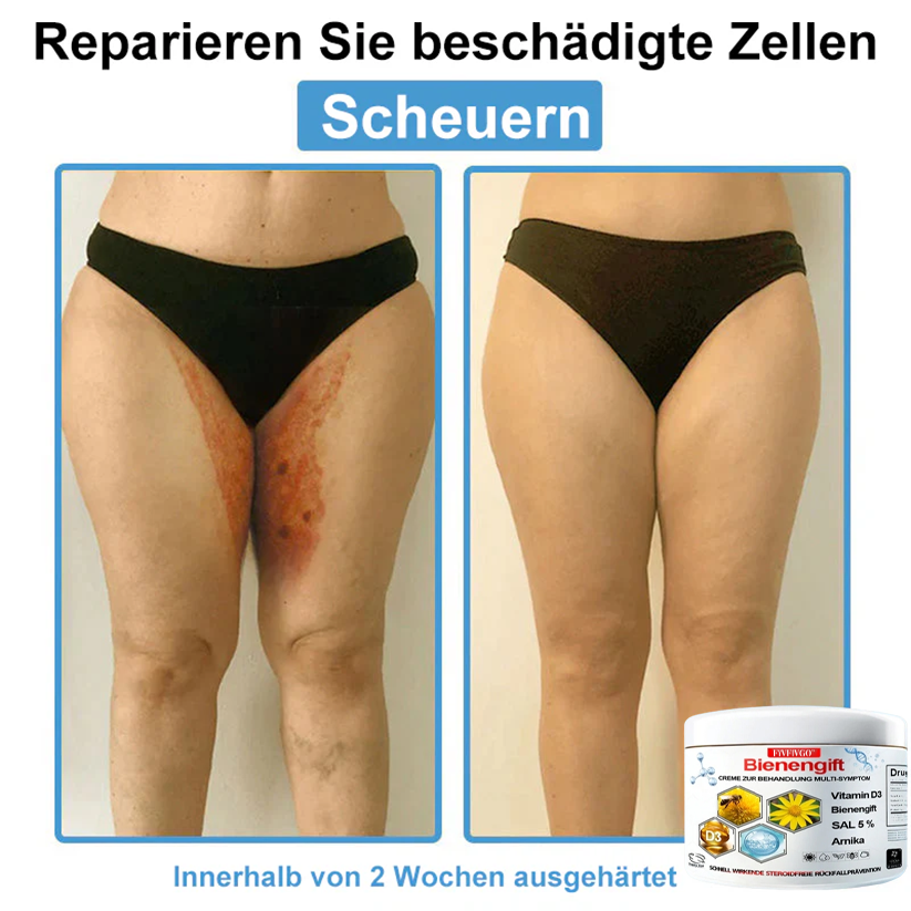 Fivfivgo™ Bienengift Creme Zur Behandlung Multi-symptom