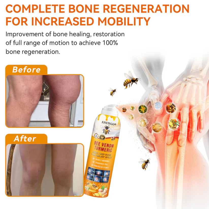 Fivfivgo® Bee Venom and Turmeric Joint and Bone Pain Relief Spray (Specialized in Joint and Arthritis Pain & Recommended by AAOS)